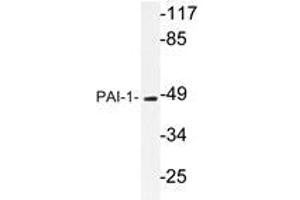 Western blot analysis of PAI-1 Antibody in extracts from Jurkat cells. (PAI1 antibody)