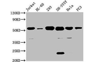 Western Blot Positive WB detected in: Jurkat whole cell lysate, HL60 whole cell lysate, 293 whole cell lysate, SH-SY5Y whole cell lysate, Hela whole cell lysate, PC-3 whole cell lysate All lanes: CYP21A2 antibody at 8 μg/mL Secondary Goat polyclonal to rabbit IgG at 1/50000 dilution Predicted band size: 56, 53 kDa Observed band size: 56 kDa (CYP21A2 antibody  (AA 312-418))