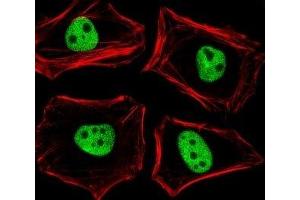 Fluorescent image of HeLa cells stained with TLE1 antibody diluted at 1:25 dilution. (TLE1 antibody  (N-Term))