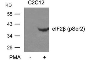 Western blot analysis of extracts from C2C12 cells untreated or treated with PMA using eIF2b(phospho-Ser2) Antibody. (EIF2S2 antibody  (pSer2))