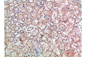 Immunohistochemical analysis of paraffin-embedded human-kidney, antibody was diluted at 1:200 (CD3 epsilon antibody  (AA 31-80))