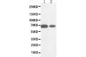 Anti-MMP16 antibody, Western blotting Lane 1: HELA Cell Lysate Lane 2: COLO320 Cell Lysate (MMP16 antibody  (C-Term))