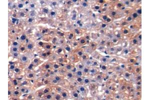 DAB staining on IHC-P; Samples: Rat Liver Tissue (ALT antibody  (AA 203-443))