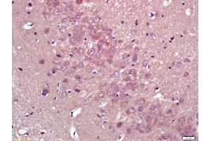 Formalin-fixed and paraffin embedded rat brain labeled with Anti-HMGCR Polyclonal Antibody, Unconjugated (ABIN709196) at 1:200 followed by conjugation to the secondary antibody and DAB staining (HMGCR antibody  (AA 251-350))