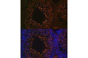 Immunofluorescence analysis of rat testis using LDHB antibody (ABIN7268168) at dilution of 1:100. (LDHAL6B antibody  (AA 1-80))