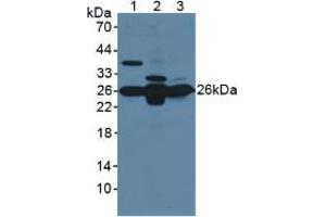 Western blot analysis of (1) Mouse Brain Tissue, (2) Mouse Liver Tissue and (3) Mouse Kidney Tissue. (GSTM1 antibody  (AA 1-218))