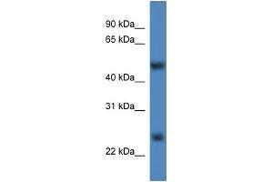WB Suggested Anti-Mettl4 Antibody Titration:  0. (METTL4 antibody  (C-Term))