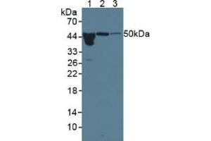 Western blot analysis of (1) Human Serum, (2) Rat Pancreas Tissue and (3) Rat Bladder Tissue. (ORM1 antibody  (AA 19-201))