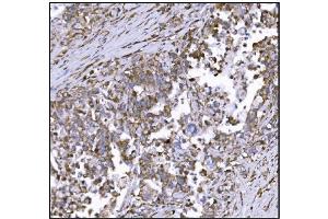 IHC analysis of LRP1B using anti-LRP1B antibody (ABIN7601521). (LRP1B antibody  (AA 3704-4547))