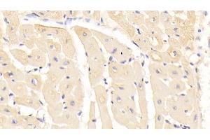 Detection of RARS in Human Cardiac Muscle Tissue using Monoclonal Antibody to Arginyl tRNA Synthetase (RARS) (RARS antibody  (AA 1-146))