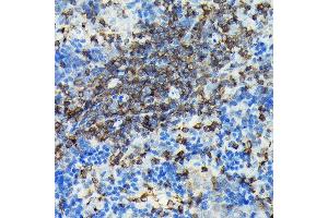 Immunohistochemistry of paraffin-embedded rat spleen using PIK3CG Rabbit pAb (ABIN6130600, ABIN6145638, ABIN6145639 and ABIN6222396) at dilution of 1:100 (40x lens). (PIK3 gamma antibody  (AA 1-200))