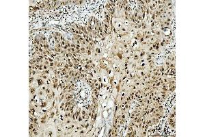 IHC analysis of SFPQ using anti-SFPQ antibody (ABIN7603089).