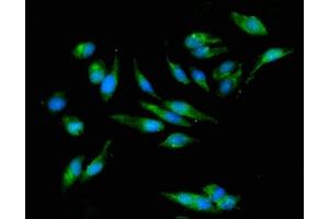 Immunofluorescent analysis of Hela cells using ABIN7162799 at dilution of 1:100 and Alexa Fluor 488-congugated AffiniPure Goat Anti-Rabbit IgG(H+L) (PPIC antibody  (AA 26-188))