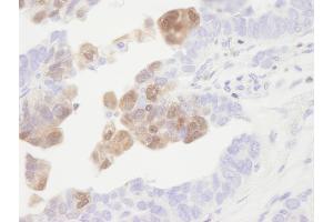 Immunohistochemistry (IHC) image for anti-Calcium/calmodulin-Dependent Protein Kinase IV (CAMK4) (C-Term) antibody (ABIN7448455)