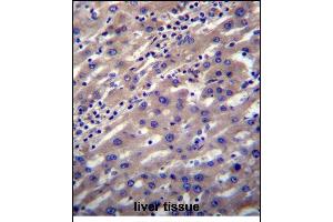 SCP2 Antibody (N-term) (ABIN656448 and ABIN2845733) immunohistochemistry analysis in formalin fixed and paraffin embedded human liver tissue followed by peroxidase conjugation of the secondary antibody and DAB staining.
