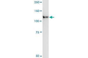 Immunoprecipitation of LLGL2 transfected lysate using anti-LLGL2 MaxPab rabbit polyclonal antibody and Protein A Magnetic Bead , and immunoblotted with LLGL2 purified MaxPab mouse polyclonal antibody (B01P) . (LLGL2 antibody  (AA 1-1020))