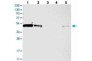 Western blot analysis of Lane 1: RT-4, Lane 2: U-251 MG, Lane 3: Human Plasma, Lane 4: Liver, Lane 5: Tonsil with ZNF787 polyclonal antibody  at 1:250-1:500 dilution. (ZNF787 antibody)