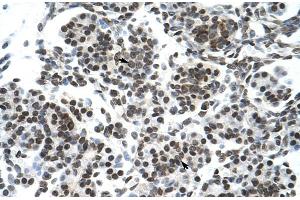 Rabbit Anti-ZNF394 Antibody Catalog Number: ARP30072 Paraffin Embedded Tissue: Human Pancreas Cellular Data: Epithelial cells of pancreatic acinus Antibody Concentration: 4. (ZNF394 antibody  (N-Term))