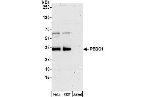 anti-Chromosome X Open Reading Frame 26 (CXorf26) (AA 1-50) antibody