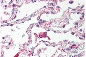 Human Lung, Alveolar Macrophages (formalin-fixed, paraffin-embedded) stained with TLR6 antibody ABIN214529 at 5 ug/ml followed by biotinylated goat anti-rabbit IgG secondary antibody ABIN481713, alkaline phosphatase-streptavidin and chromogen. (TLR6 antibody  (Internal Region))