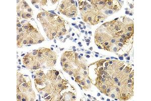 Immunohistochemistry of paraffin-embedded Human normal stomach using CHIT1 Polyclonal Antibody at dilution of 1:200 (40x lens). (Chitotriosidase 1 antibody)