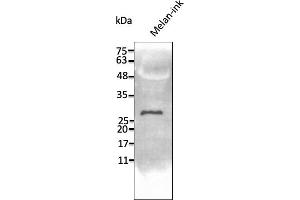 Western Blotting (WB) image for anti-Transmembrane Protein 160 (TMEM160) (C-Term) antibody (ABIN7273067) (TMEM160 antibody  (C-Term))