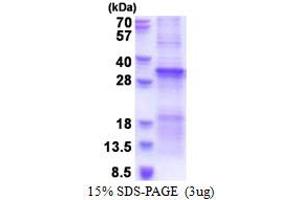 SDS-PAGE (SDS) image for Transforming Growth Factor, beta Receptor Associated Protein 1 (TGFBRAP1) (AA 601-860) protein (His tag) (ABIN5853583)