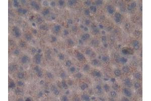 Detection of MUC1 in Rat Liver Tissue using Polyclonal Antibody to Mucin 1 (MUC1) (MUC1 antibody  (AA 404-655))