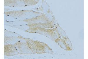 ABIN6276446 at 1/100 staining Mouse muscle tissue by IHC-P. (Hexokinase 2 antibody  (C-Term))