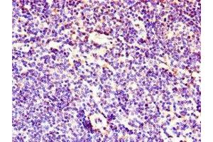 Immunohistochemistry of paraffin-embedded human lymph node tissue using ABIN7158656 at dilution of 1:100 (LEF1 antibody  (AA 75-216))