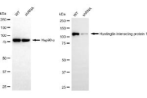 Western blotting analysis using huntingtin interacting protein 1 antibody (ABIN7799006).