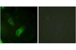 Immunofluorescence (IF) image for anti-Aconitase 1 (ACO1) (AA 106-155) antibody (ABIN2888890) (Aconitase 1 antibody  (AA 106-155))