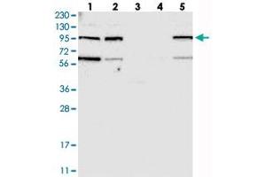 Western blot analysis of Lane 1: RT-4, Lane 2: U-251 MG, Lane 3: Human Plasma, Lane 4: Liver, Lane 5: Tonsil with KIAA0753 polyclonal antibody  at 1:250-1:500 dilution.