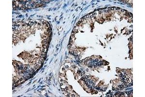 Immunohistochemical staining of paraffin-embedded Kidney tissue using anti-XRCC1mouse monoclonal antibody. (XRCC1 antibody)