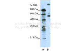 Host: Rabbit Target Name: HTR7 Sample Tissue: Human Jurkat Antibody Dilution: 1ug/ml (HTR7 antibody  (N-Term))