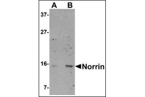 Western blot analysis of Norrin in Jurkat cell lysate with this product at (A) 1 and (B) 2 μg/ml.