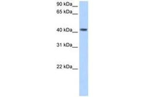 Image no. 1 for anti-Pregnancy Specific beta-1-Glycoprotein 5 (PSG5) (AA 71-120) antibody (ABIN204983)