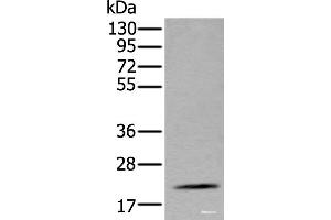 Western blot analysis of Mouse fat tissue lysate using ZFAND5 Polyclonal Antibody at dilution of 1:500 (ZFAND5 antibody)