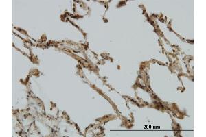 Immunoperoxidase of monoclonal antibody to CRIM1 on formalin-fixed paraffin-embedded human lung. (CRIM1 antibody  (AA 36-145))