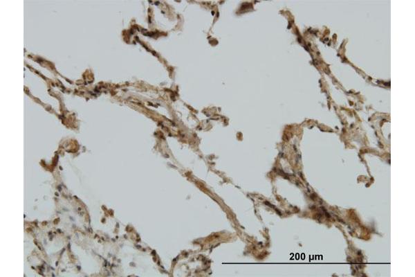 CRIM1 antibody  (AA 36-145)