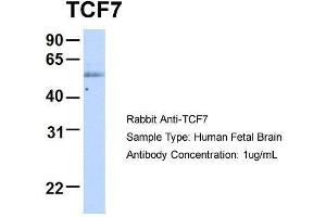 Host:  Rabbit  Target Name:  TCF7  Sample Type:  Human Fetal Brain  Antibody Dilution:  1. (TCF7 antibody  (Middle Region))