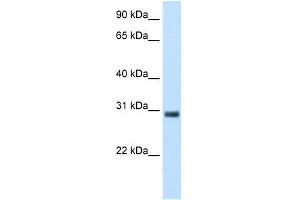 KCTD6 antibody used at 5 ug/ml to detect target protein. (KCTD6 antibody  (N-Term))