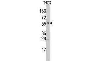 Western blot analysis of ALDH6A1 polyclonal antibody  in T-47D cell line lysates (35 ug/lane).