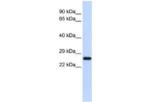 SOD2 antibody used at 1 ug/ml to detect target protein.