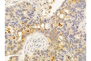 anti-Glutamine Synthetase (GLN1) (C-Term) antibody