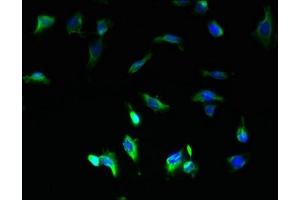 Immunofluorescent analysis of U251 cells using ABIN7149126 at dilution of 1:100 and Alexa Fluor 488-congugated AffiniPure Goat Anti-Rabbit IgG(H+L) (UBXN11 antibody  (AA 38-146))