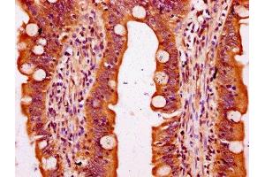 IHC image of ABIN7169980 diluted at 1:300 and staining in paraffin-embedded human small intestine tissue performed on a Leica BondTM system. (SLC6A19 antibody  (AA 326-413))
