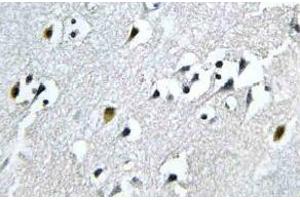 Immunohistochemistry (IHC) analyzes of N4BP1 antibody in paraffin-embedded human brain tissue. (N4BP1 antibody)