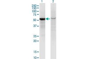 Western Blot analysis of GPI expression in transfected 293T cell line by GPI monoclonal antibody (M01), clone 8B8. (GPI antibody  (AA 1-558))