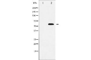 Western blot analysis of SOX9 expression in NIH-3T3 whole cell lysates,The lane on the left is treated with the antigen-specific peptide. (SOX9 antibody)